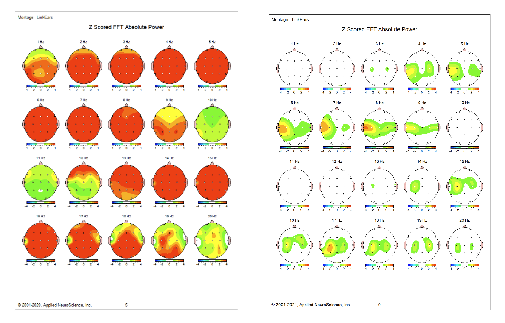 Neurofeedback