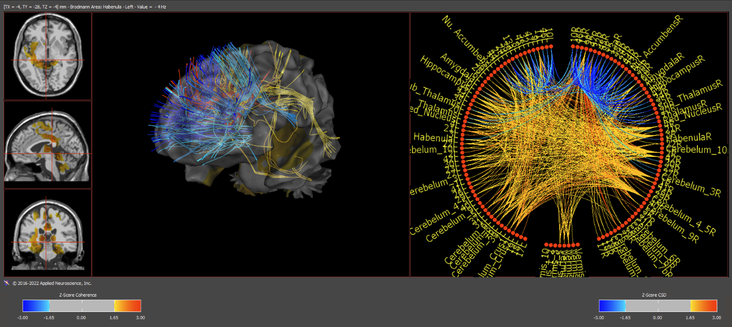 Connectome brain map