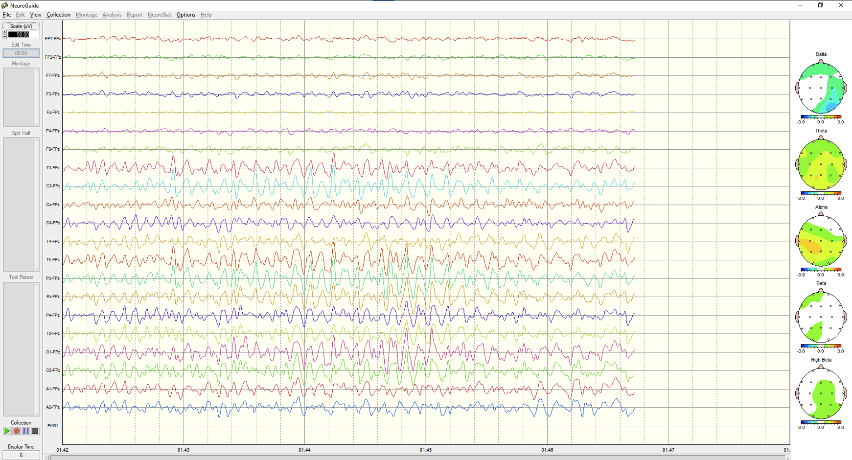 QEEG